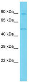 Ankyrin Repeat Domain 10 antibody, TA330686, Origene, Western Blot image 