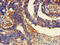 Scavenger Receptor Class B Member 2 antibody, orb51610, Biorbyt, Immunohistochemistry paraffin image 