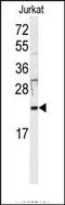 HRas Proto-Oncogene, GTPase antibody, AP14550PU-N, Origene, Western Blot image 