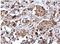 RAD51 Recombinase antibody, NBP2-20058, Novus Biologicals, Immunohistochemistry paraffin image 