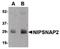 Nipsnap Homolog 2 antibody, PA5-20655, Invitrogen Antibodies, Western Blot image 