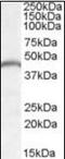 Patatin Like Phospholipase Domain Containing 3 antibody, orb94922, Biorbyt, Western Blot image 