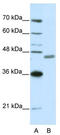 Zinc Finger Protein 396 antibody, TA345527, Origene, Western Blot image 