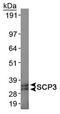 Synaptonemal Complex Protein 3 antibody, PA1-16766, Invitrogen Antibodies, Western Blot image 