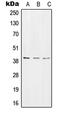 RNA 3'-Terminal Phosphate Cyclase antibody, MBS820971, MyBioSource, Western Blot image 