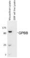 Glycogen Phosphorylase B antibody, 54-306, ProSci, Enzyme Linked Immunosorbent Assay image 