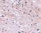 SATB Homeobox 1 antibody, LS-C53327, Lifespan Biosciences, Immunohistochemistry paraffin image 