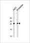 Stratifin antibody, PA5-35219, Invitrogen Antibodies, Western Blot image 