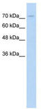 CAGH44 antibody, TA334255, Origene, Western Blot image 