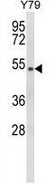 General Transcription Factor IIH Subunit 4 antibody, GTX81063, GeneTex, Western Blot image 