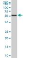 Fibrinogen Like 2 antibody, H00010875-M01, Novus Biologicals, Western Blot image 