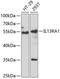 Interleukin-13 receptor subunit alpha-1 antibody, GTX33259, GeneTex, Western Blot image 