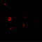 Interleukin 1 Receptor Like 2 antibody, 7501, ProSci Inc, Immunofluorescence image 