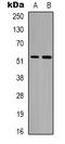 Tubulin Alpha 1a antibody, orb339083, Biorbyt, Western Blot image 