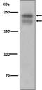 Kinase Insert Domain Receptor antibody, M00901, Boster Biological Technology, Western Blot image 