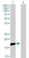 Roundabout Guidance Receptor 3 antibody, H00064221-B01P, Novus Biologicals, Western Blot image 