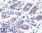 ATP Binding Cassette Subfamily B Member 5 antibody, LS-B3454, Lifespan Biosciences, Immunohistochemistry paraffin image 