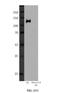 Unc-13 Homolog D antibody, NB100-41385, Novus Biologicals, Western Blot image 