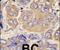 Heat Shock Protein Family B (Small) Member 1 antibody, PA5-14021, Invitrogen Antibodies, Immunohistochemistry frozen image 