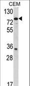 Transglutaminase 4 antibody, LS-C161838, Lifespan Biosciences, Western Blot image 