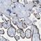 Pappalysin 1 antibody, NBP2-21614, Novus Biologicals, Immunohistochemistry frozen image 