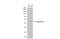 Keratin 7 antibody, GTX110414, GeneTex, Western Blot image 