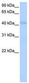 Kelch Like Family Member 42 antibody, TA339241, Origene, Western Blot image 