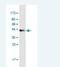 Tetratricopeptide Repeat Domain 9C antibody, H00283237-M06-100ug, Novus Biologicals, Western Blot image 