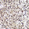 Checkpoint Kinase 2 antibody, LS-C746740, Lifespan Biosciences, Immunohistochemistry frozen image 
