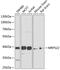 Mitochondrial Ribosomal Protein S22 antibody, GTX66109, GeneTex, Western Blot image 