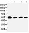 SERPINC1 antibody, PA2218, Boster Biological Technology, Western Blot image 