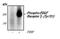 Platelet Derived Growth Factor Receptor Beta antibody, MA5-15192, Invitrogen Antibodies, Western Blot image 