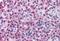 STEAP3 Metalloreductase antibody, MBS241320, MyBioSource, Immunohistochemistry paraffin image 