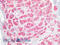 Methylenetetrahydrofolate Dehydrogenase (NADP+ Dependent) 1 Like antibody, 42-396, ProSci, Immunohistochemistry paraffin image 