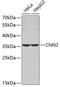 Calponin 2 antibody, 19-022, ProSci, Western Blot image 