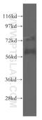 CRSBP-1 antibody, 51011-1-AP, Proteintech Group, Western Blot image 