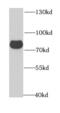 Glycerol-3-Phosphate Dehydrogenase 2 antibody, FNab03581, FineTest, Western Blot image 