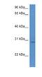 UTP23 Small Subunit Processome Component antibody, NBP1-79832, Novus Biologicals, Western Blot image 