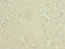 ATP Synthase F1 Subunit Delta antibody, LS-C675401, Lifespan Biosciences, Immunohistochemistry paraffin image 