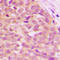Mitogen-Activated Protein Kinase Kinase Kinase 8 antibody, LS-C358799, Lifespan Biosciences, Immunohistochemistry paraffin image 