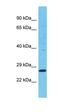 Tetraspanin 11 antibody, orb327131, Biorbyt, Western Blot image 