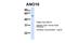 Anoctamin 10 antibody, ARP47389_P050, Aviva Systems Biology, Western Blot image 