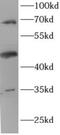 Endoglin antibody, FNab10035, FineTest, Western Blot image 