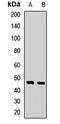 GDNF Family Receptor Alpha 3 antibody, LS-B16754, Lifespan Biosciences, Western Blot image 