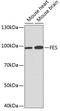 FES Proto-Oncogene, Tyrosine Kinase antibody, GTX54025, GeneTex, Western Blot image 