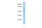 Protein Zfp566 antibody, A30342, Boster Biological Technology, Western Blot image 