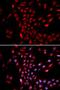 Karyopherin Subunit Alpha 4 antibody, orb167159, Biorbyt, Immunofluorescence image 