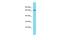 Protein Phosphatase 1 Regulatory Subunit 37 antibody, A14507, Boster Biological Technology, Western Blot image 