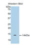 Interleukin 10 Receptor Subunit Alpha antibody, LS-C300096, Lifespan Biosciences, Western Blot image 