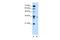 Lymphocyte Antigen 6 Family Member G6F antibody, A12567, Boster Biological Technology, Western Blot image 